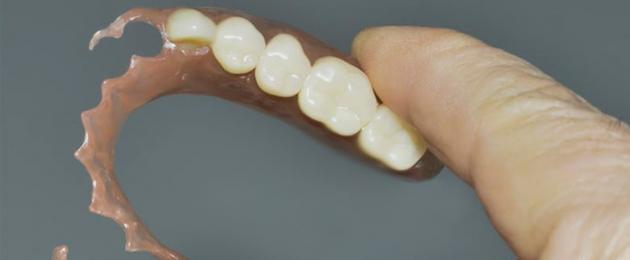 Что такое гибкие протезы для зубов. Гибкие зубные протезы что это такое. Мягкое протезирование зубов